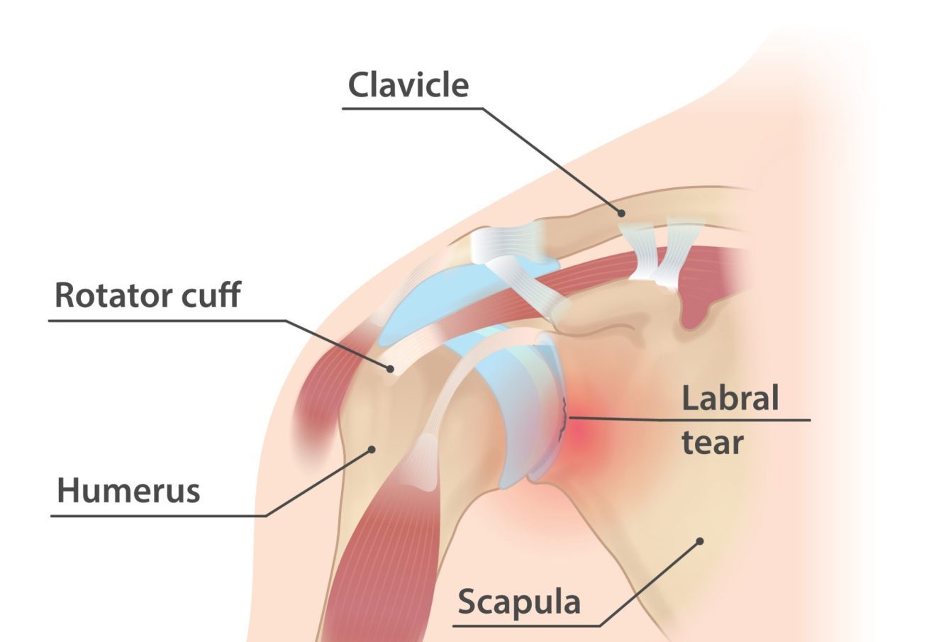 Shoulder Arthroscopy FAQs by Dr. Jigar Desai